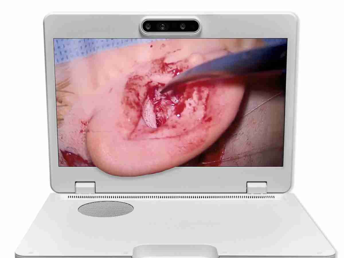 达擎之＂Heads-up 3D显微手术显示系统＂，，，，整合4K裸眼3D显示及眼球追踪系统，，，具备快速追踪人眼移动位置功能，，，，减轻医师长时间维持固定姿势的负担，，，，让医师能有更宽广清晰的3D立体视野及更舒适的姿势来执行手术。。。